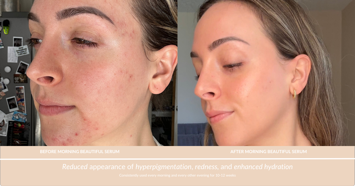 Morning Beautiful Brightening Peptide Serum